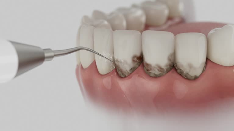 Reliable Teeth Cleaning And Checkup contractor in Charles City County County, VA by Dentist Open Now